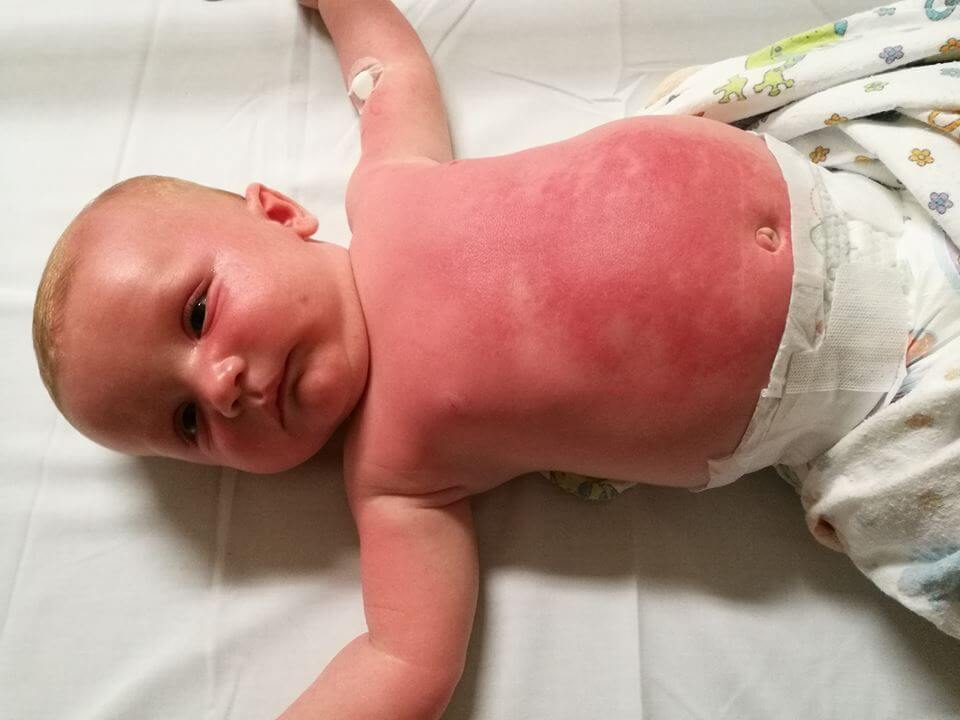 Worst sunscreen best sale for babies