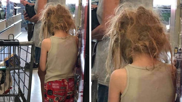 The Reason This Child's Tangled Hair Has Gone Viral Is Breaking Hearts  Across America