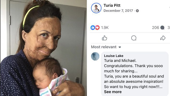 Hunky Husband Is Asked If He’ll Leave Wife After a Fire Destroys Her Looks—His Response Is Perfect