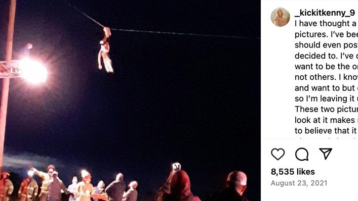 Teen Left Hanging by Broken Leg on Power Line After Crash Shares Scariest Part of Ordeal