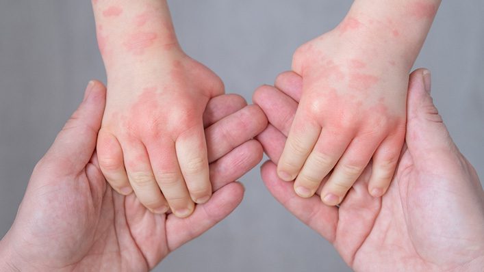 I Was Giving My Son the Very Thing That Was Killing Him & Had No Idea